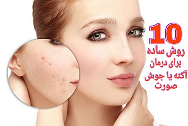 10 روش ساده برای درمان آکنه یا جوش صورت